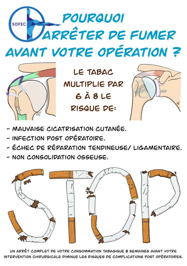 Prévention anti-tabac SoFEC